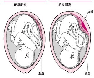 z1301716179wcmgs